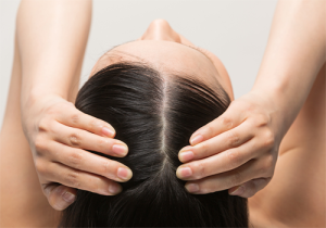 జుట్టు కుదుళ్లను బలంగా ఉంచే విటమిన్లు ఇవే..!